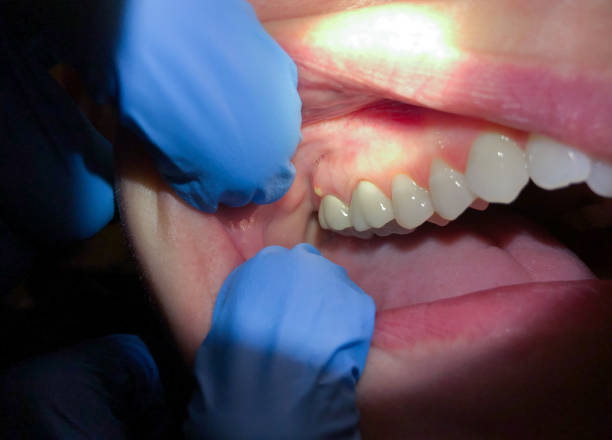 Best Tooth Infection Emergency Dentist  in Middletown, PA