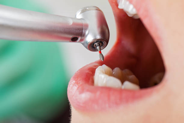 Best Broken Tooth Emergency  in Middletown, PA